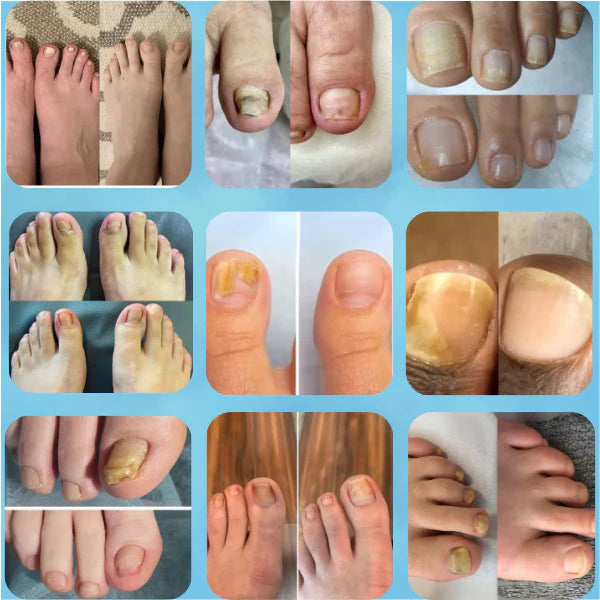 Medicole Laser Pro™